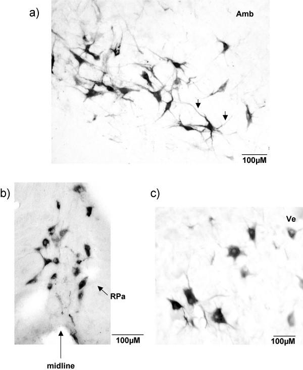 https://cdn.ncbi.nlm.nih.gov/pmc/blobs/b6a2/1919385/4ac66d53d0c2/1471-2202-8-40-1.jpg