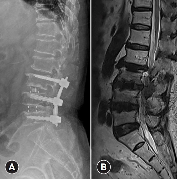 https://cdn.ncbi.nlm.nih.gov/pmc/blobs/b6aa/11294787/f6d269b094e3/jyms-2024-00339f1.jpg