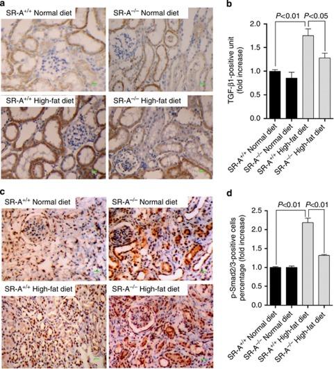 https://cdn.ncbi.nlm.nih.gov/pmc/blobs/b6b7/3343314/9f56ee846e8a/ki2011457f6.jpg