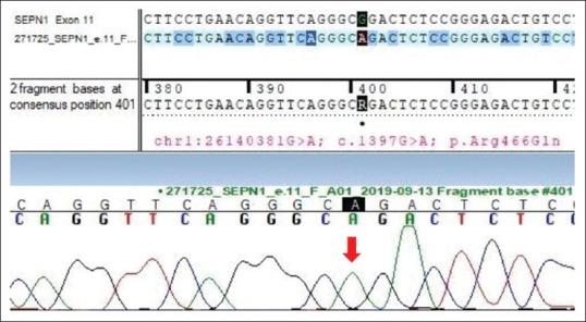 https://cdn.ncbi.nlm.nih.gov/pmc/blobs/b6bc/8965955/531fcd27ca6b/AIAN-24-955-g002.jpg