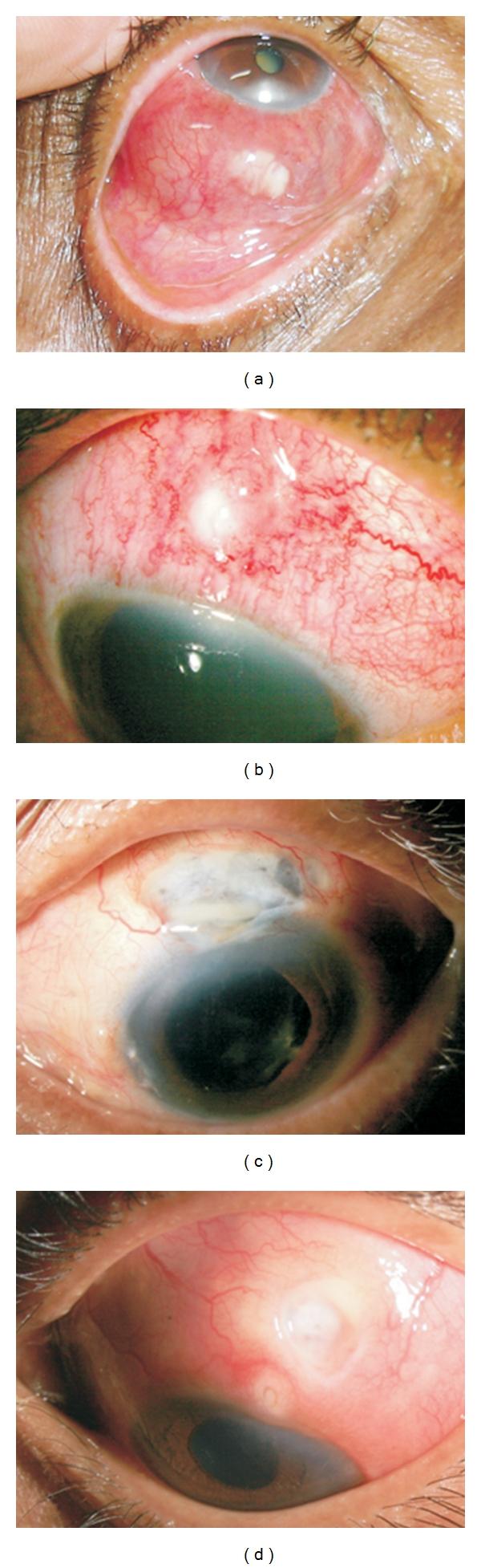 https://cdn.ncbi.nlm.nih.gov/pmc/blobs/b6c2/3227473/064fef34a546/IJI2012-753560.001.jpg