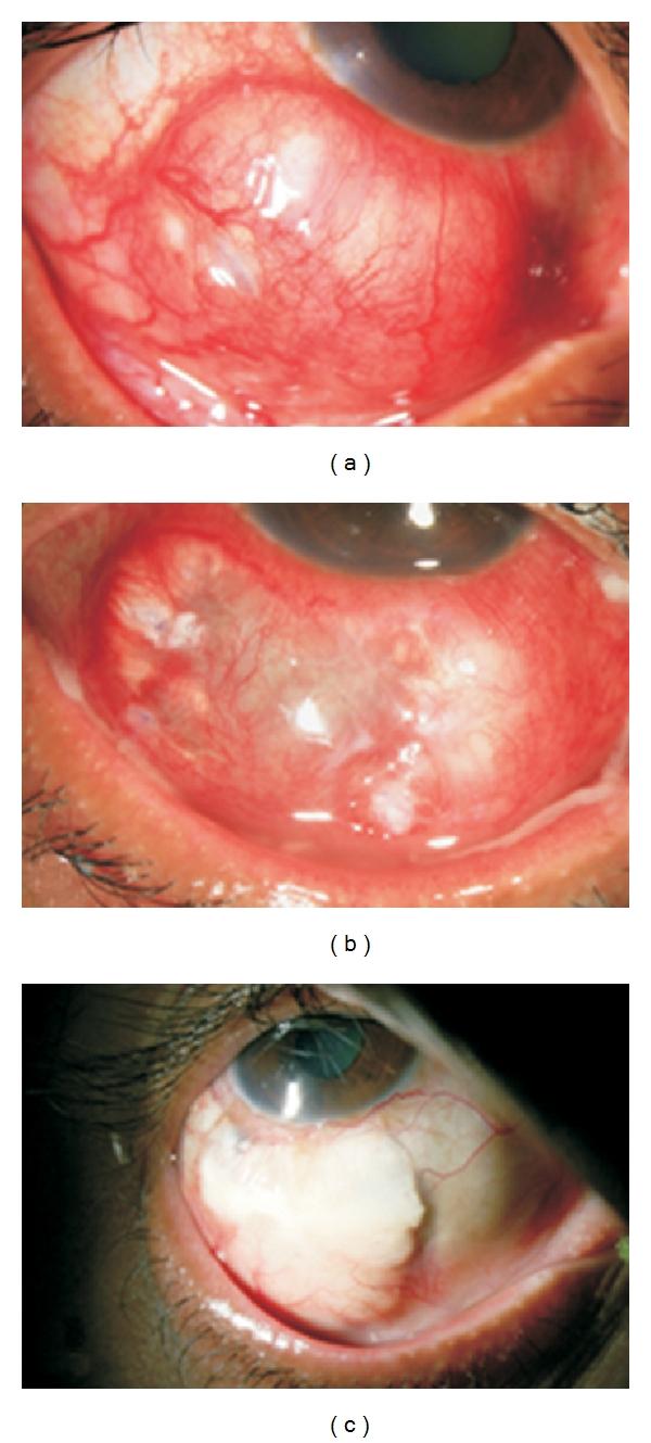 https://cdn.ncbi.nlm.nih.gov/pmc/blobs/b6c2/3227473/c578d40ed02e/IJI2012-753560.002.jpg