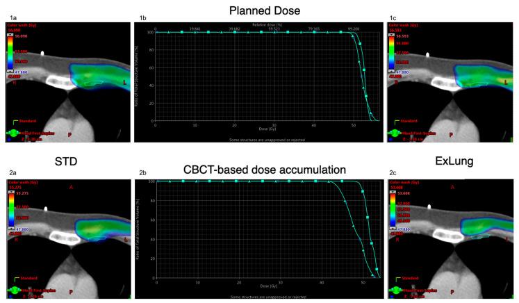 https://cdn.ncbi.nlm.nih.gov/pmc/blobs/b6c3/8073233/dc45b33f5ccf/cancers-13-01951-g003.jpg