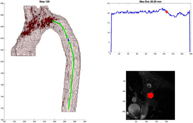 https://cdn.ncbi.nlm.nih.gov/pmc/blobs/b6cd/11135202/9d1375bd41f9/JMI-011-034503-g007.jpg