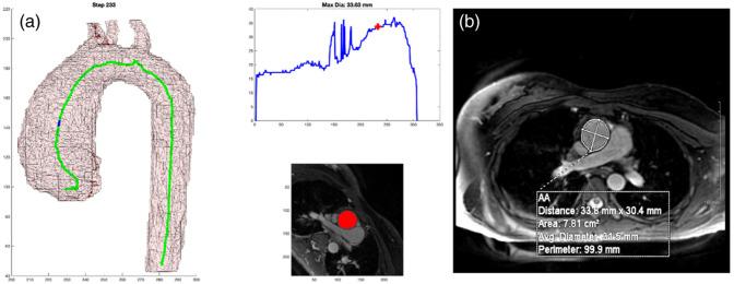 https://cdn.ncbi.nlm.nih.gov/pmc/blobs/b6cd/11135202/a06fd121c150/JMI-011-034503-g005.jpg