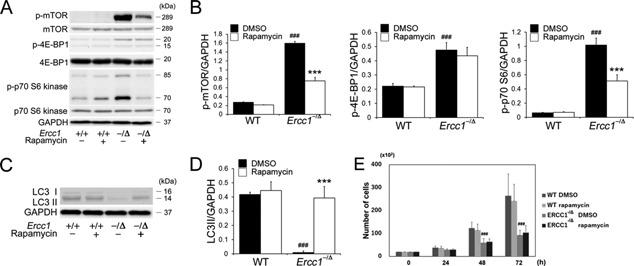 https://cdn.ncbi.nlm.nih.gov/pmc/blobs/b6cf/5516198/0332258bde3b/JOR-35-1375-g001.jpg