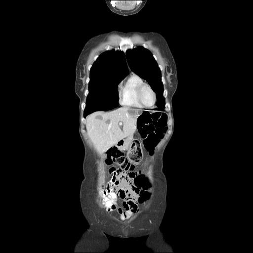 https://cdn.ncbi.nlm.nih.gov/pmc/blobs/b6da/4564031/dbd0cdea172a/JMedLife-08-4-g005.jpg