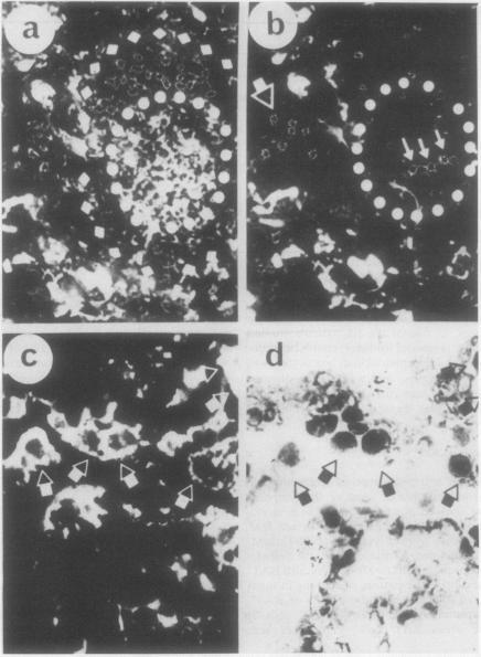 https://cdn.ncbi.nlm.nih.gov/pmc/blobs/b6dc/460088/7ca237963152/thorax00234-0008-a.jpg