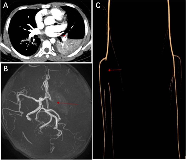 https://cdn.ncbi.nlm.nih.gov/pmc/blobs/b6e1/9392343/d841453d00a8/13052_2022_1344_Fig2_HTML.jpg