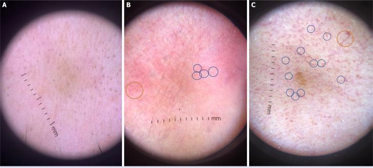 https://cdn.ncbi.nlm.nih.gov/pmc/blobs/b6e2/10861432/6026b2d80e0e/NCI-11-027-g001.jpg