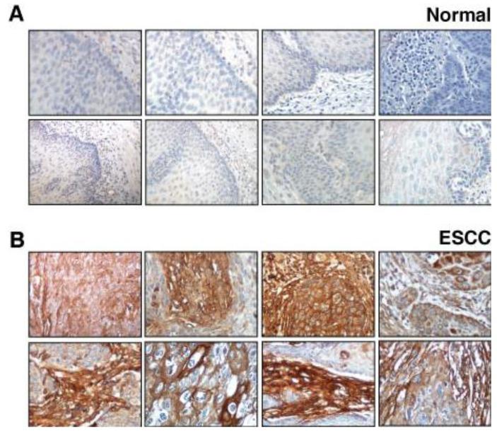 https://cdn.ncbi.nlm.nih.gov/pmc/blobs/b6e3/3827595/0cbdfd713c49/cancers-02-00133-g002.jpg