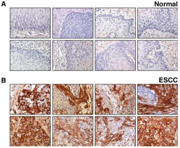 https://cdn.ncbi.nlm.nih.gov/pmc/blobs/b6e3/3827595/c7e86aa78973/cancers-02-00133-g003.jpg