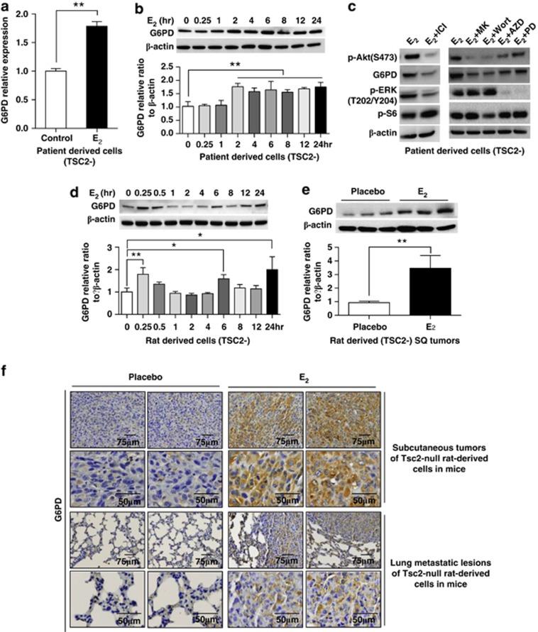 https://cdn.ncbi.nlm.nih.gov/pmc/blobs/b6e4/4047866/97056bbfbec7/cddis2014204f4.jpg