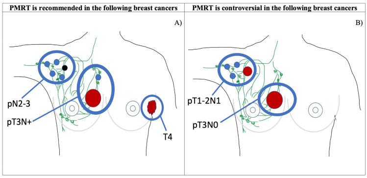 https://cdn.ncbi.nlm.nih.gov/pmc/blobs/b6e5/11728050/3a7fab0cdcbc/jcm-13-07545-g002.jpg
