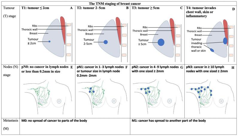 https://cdn.ncbi.nlm.nih.gov/pmc/blobs/b6e5/11728050/be369fef0fc1/jcm-13-07545-g001.jpg