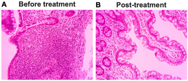 https://cdn.ncbi.nlm.nih.gov/pmc/blobs/b6ea/12346882/f31602218254/ijms-26-07292-g004.jpg