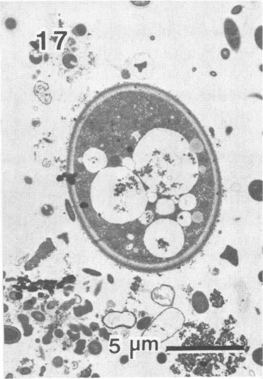 https://cdn.ncbi.nlm.nih.gov/pmc/blobs/b6f1/240336/0fd02907d3d2/aem00152-0140-c.jpg