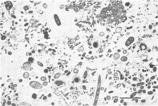 https://cdn.ncbi.nlm.nih.gov/pmc/blobs/b6f1/240336/3446c6251688/aem00152-0140-a.jpg