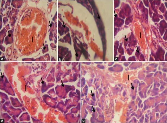 https://cdn.ncbi.nlm.nih.gov/pmc/blobs/b6f4/4566782/d09ff9aecae0/JIE-4-102-g008.jpg