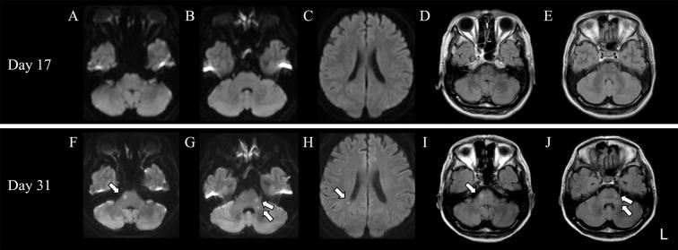 https://cdn.ncbi.nlm.nih.gov/pmc/blobs/b6fc/8355408/5addd8d69ce1/1349-7235-60-2307-g001.jpg