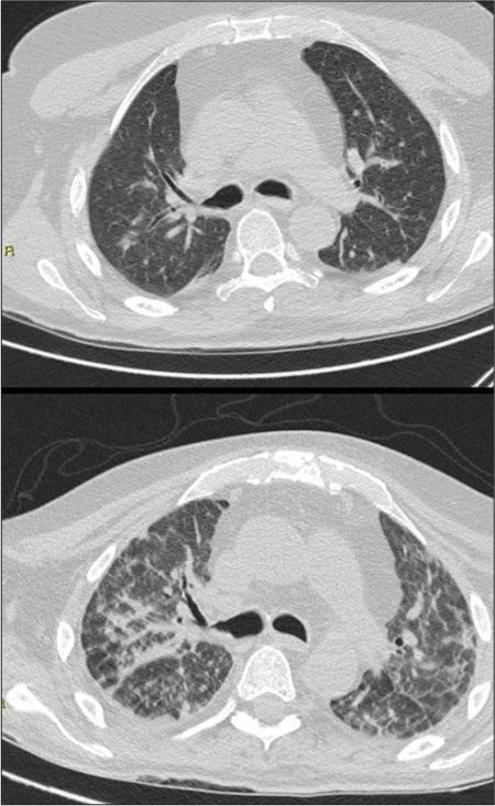 https://cdn.ncbi.nlm.nih.gov/pmc/blobs/b701/10159294/2915a02877fd/JCIS-13-10-g006.jpg