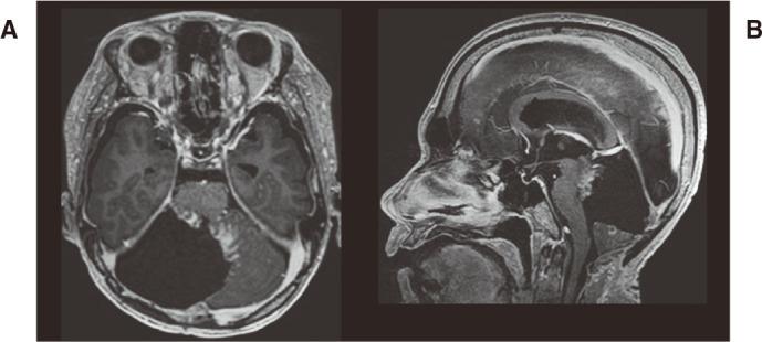 https://cdn.ncbi.nlm.nih.gov/pmc/blobs/b706/12003996/75f4f7633681/2186-3326-87-0168-g003.jpg