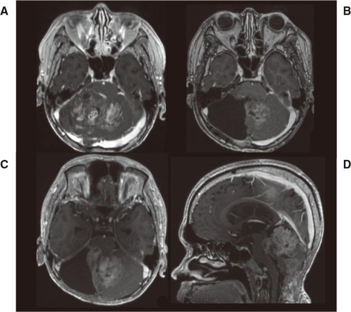 https://cdn.ncbi.nlm.nih.gov/pmc/blobs/b706/12003996/f392a2b2c185/2186-3326-87-0168-g001.jpg