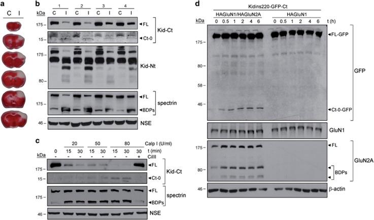 https://cdn.ncbi.nlm.nih.gov/pmc/blobs/b709/4632323/8315ed9760df/cddis2015307f2.jpg