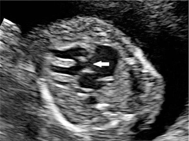 https://cdn.ncbi.nlm.nih.gov/pmc/blobs/b70d/5690727/17acbb9c3401/medi-96-e8474-g002.jpg