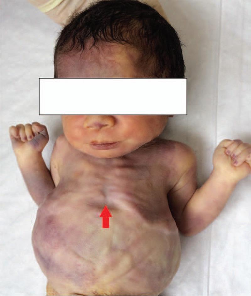 https://cdn.ncbi.nlm.nih.gov/pmc/blobs/b70d/5690727/996583e18f6b/medi-96-e8474-g006.jpg