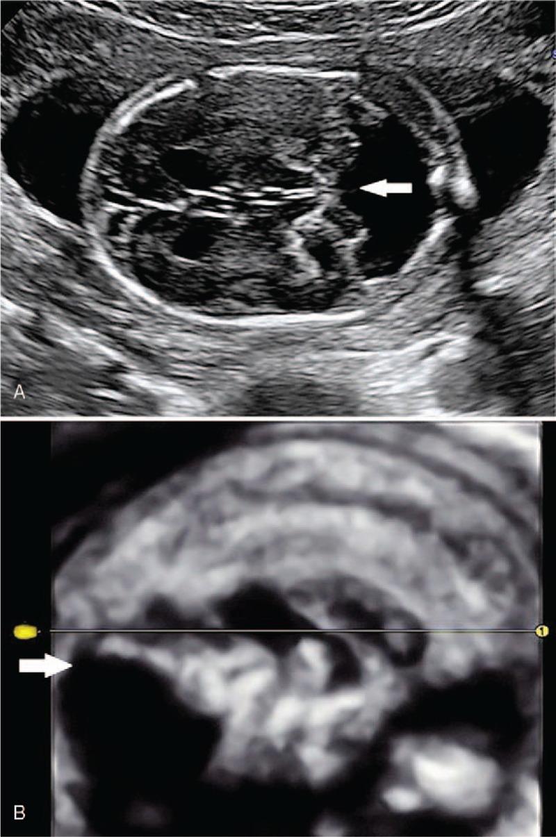 https://cdn.ncbi.nlm.nih.gov/pmc/blobs/b70d/5690727/c7df4076e682/medi-96-e8474-g001.jpg