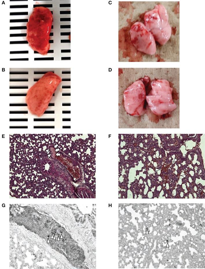 https://cdn.ncbi.nlm.nih.gov/pmc/blobs/b70d/6141968/bd39b0faecdf/fneur-09-00757-g0006.jpg