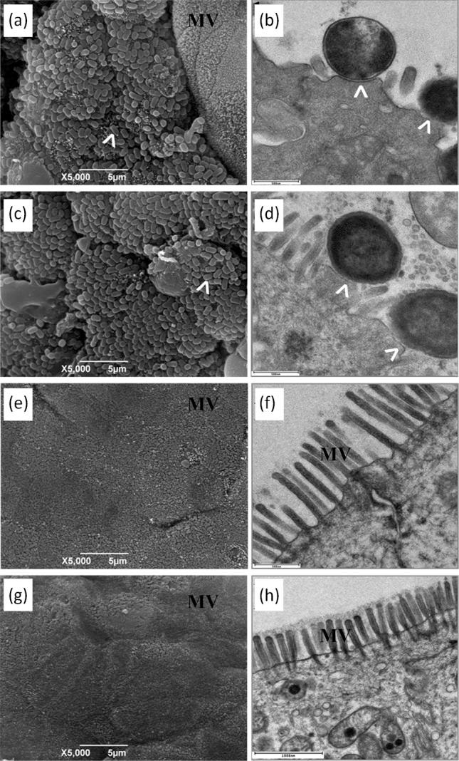 https://cdn.ncbi.nlm.nih.gov/pmc/blobs/b70e/3541765/97a35eef9472/060830-f4.jpg
