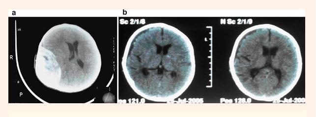 https://cdn.ncbi.nlm.nih.gov/pmc/blobs/b715/3018979/ae71b4270d07/JMedLife-02-191-g001.jpg