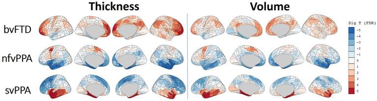 https://cdn.ncbi.nlm.nih.gov/pmc/blobs/b716/10879283/4b83802329dc/fnins-18-1331677-g006.jpg