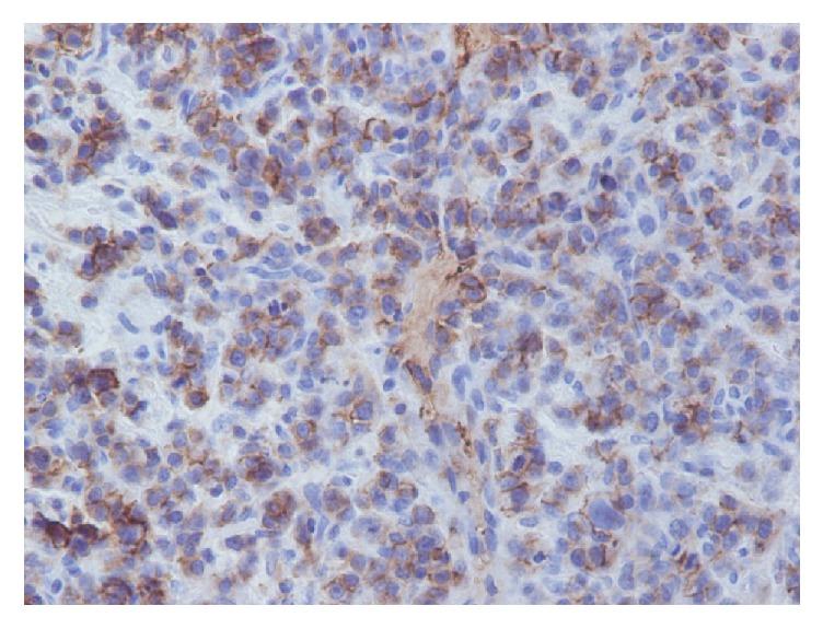 https://cdn.ncbi.nlm.nih.gov/pmc/blobs/b71c/5444033/a4da2f3b9abd/CRIONM2017-5901503.004.jpg
