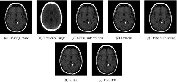 https://cdn.ncbi.nlm.nih.gov/pmc/blobs/b72e/8337131/ab23a0059120/CMMM2021-4504306.005.jpg