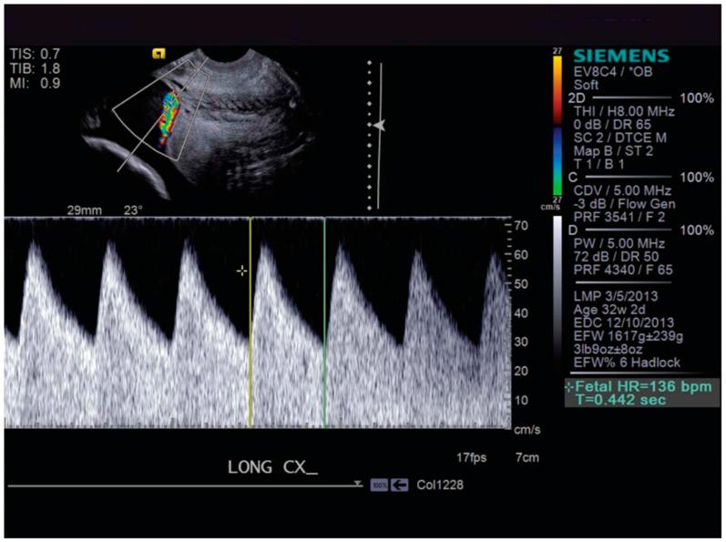 https://cdn.ncbi.nlm.nih.gov/pmc/blobs/b731/11120297/e80cb9335fc8/diagnostics-14-01016-g001.jpg