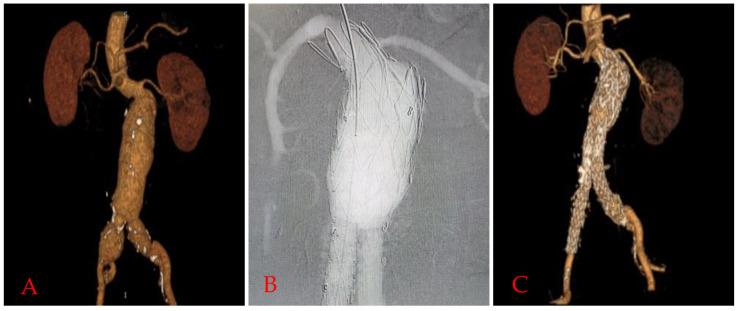 https://cdn.ncbi.nlm.nih.gov/pmc/blobs/b739/11270054/58decd9c3fd5/2153-8174-25-6-224-g1.jpg