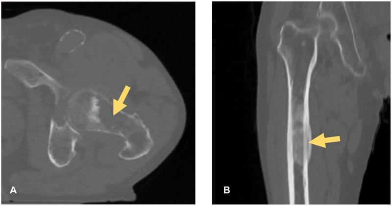 https://cdn.ncbi.nlm.nih.gov/pmc/blobs/b73e/7292864/d785a70a36e2/gr1.jpg