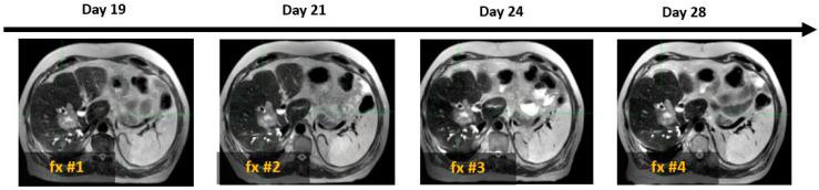 https://cdn.ncbi.nlm.nih.gov/pmc/blobs/b754/11988117/5583755b0343/cancers-17-01088-g004.jpg