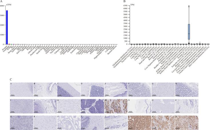 https://cdn.ncbi.nlm.nih.gov/pmc/blobs/b754/12161386/35ed13105d61/jitc-13-5-g001.jpg