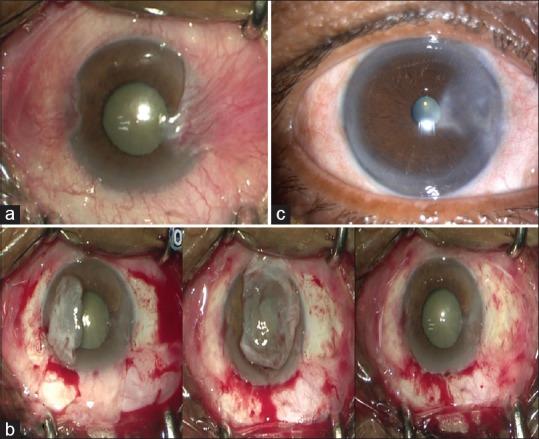 https://cdn.ncbi.nlm.nih.gov/pmc/blobs/b754/7210860/9c05fe169ebd/IJO-68-573-g001.jpg