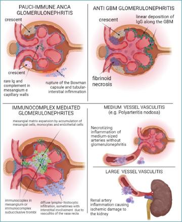 https://cdn.ncbi.nlm.nih.gov/pmc/blobs/b756/11138762/02f42f6c3660/pathol-2024-02-104-g001.jpg