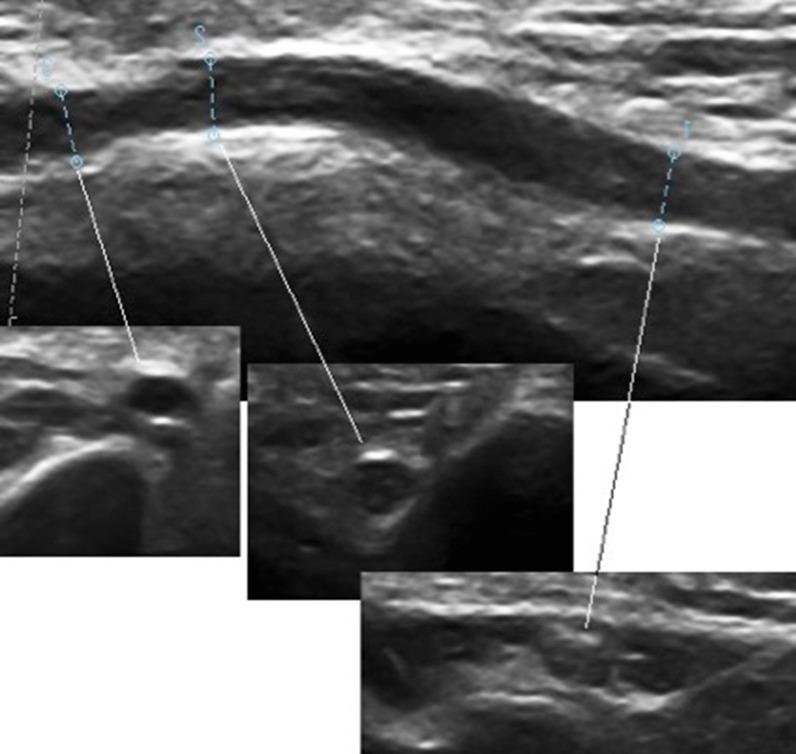 https://cdn.ncbi.nlm.nih.gov/pmc/blobs/b756/9878874/68cfbdcc8b56/42466_2023_230_Fig2_HTML.jpg