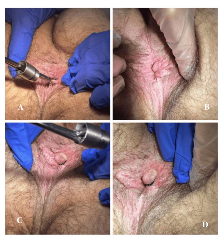https://cdn.ncbi.nlm.nih.gov/pmc/blobs/b75c/12417224/6ce53c5ad4bc/cureus-0017-00000089701-i01.jpg