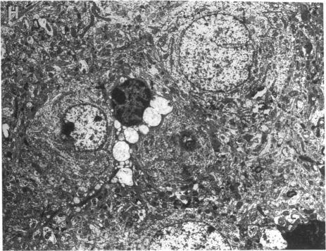 https://cdn.ncbi.nlm.nih.gov/pmc/blobs/b763/294437/17ca995a87d4/jcinvest00035-0037-h.jpg