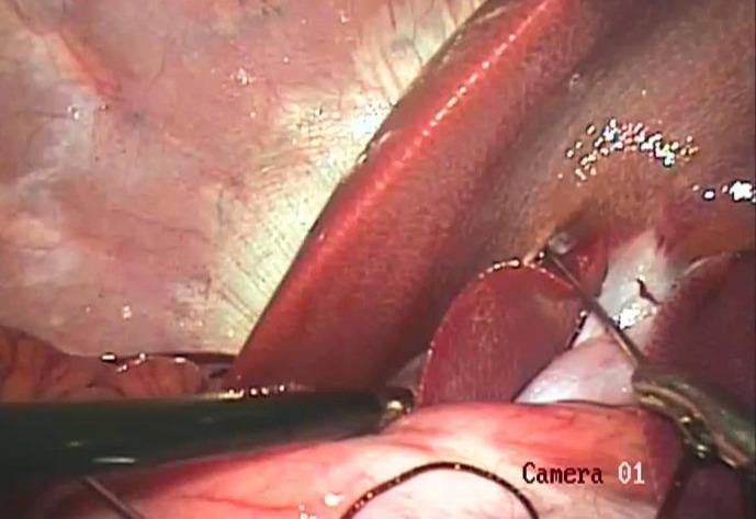 https://cdn.ncbi.nlm.nih.gov/pmc/blobs/b767/8094135/fdfd433abe22/vrf-12-1-g004.jpg