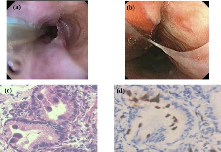 https://cdn.ncbi.nlm.nih.gov/pmc/blobs/b775/11737363/960613c5a2d8/j_med-2024-1019-fig002.jpg