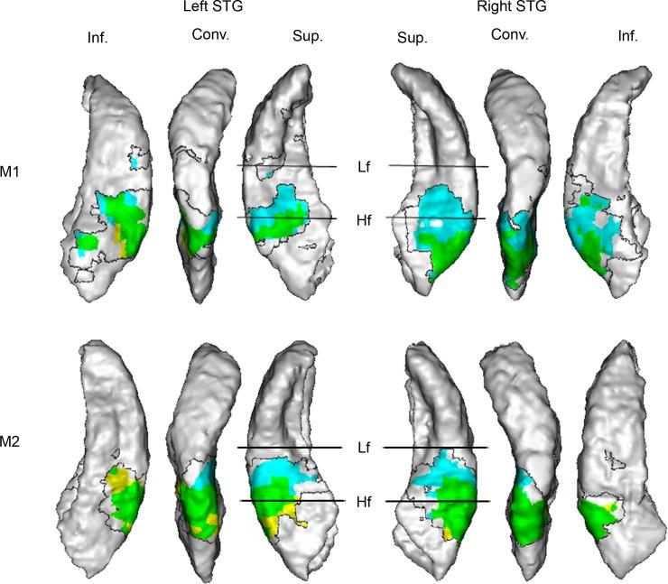 https://cdn.ncbi.nlm.nih.gov/pmc/blobs/b775/5417421/1f6ae37b9a01/pbio.2001379.g004.jpg